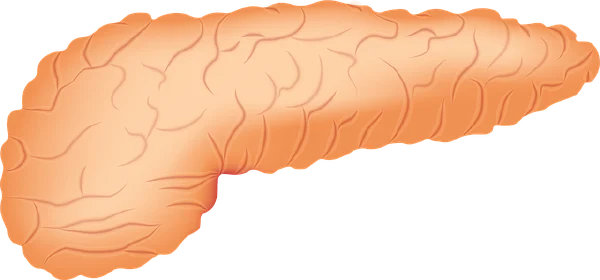 了解胰腺占位的诊治:从分类到治疗