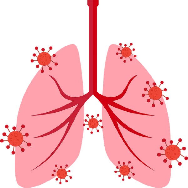 慢性阻塞性肺疾病：从病因到治疗，全面解析