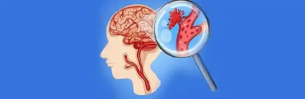 深入了解鞍区病变与高血压的诊断与管理