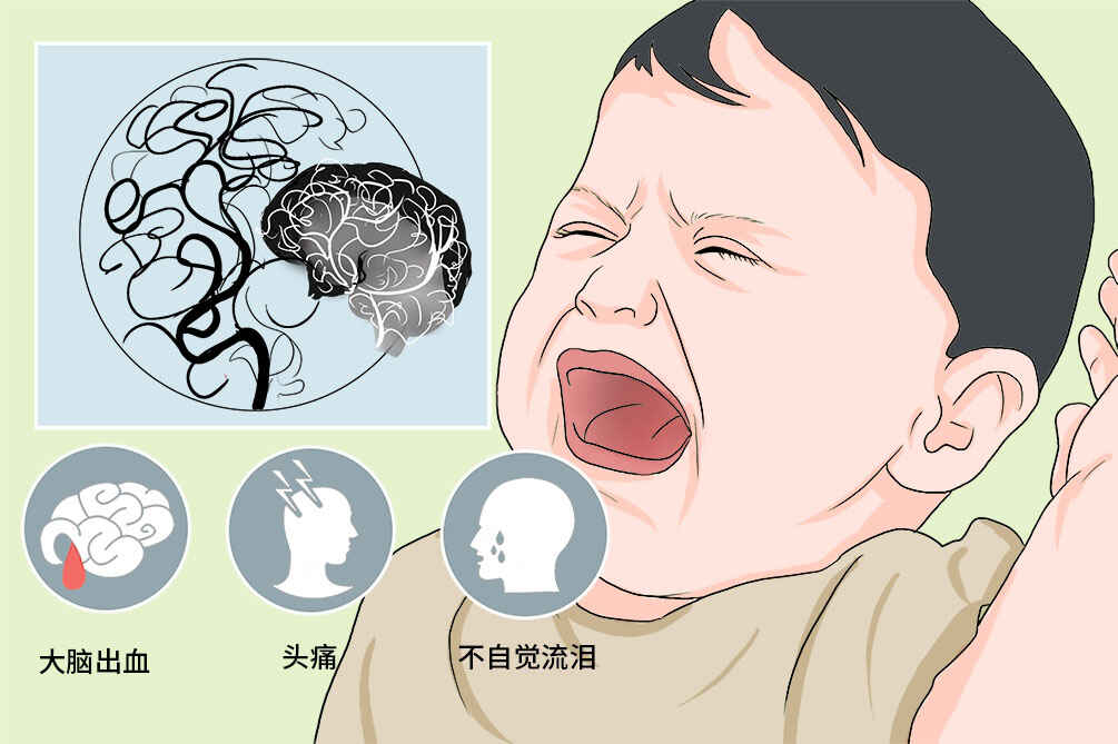 全面了解出血型烟雾病——从诊断到治疗封面图