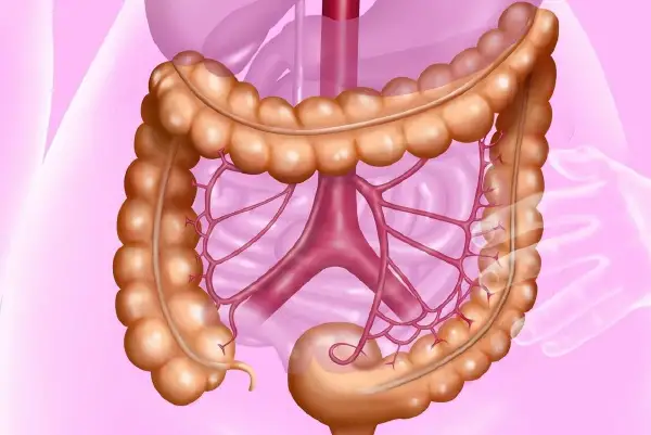 结肠肿瘤:预防、治疗与自我保护