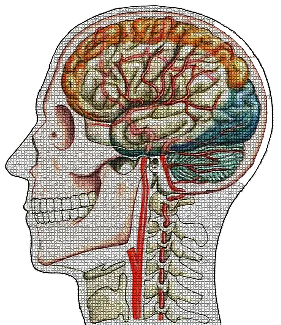 <神秘的脑出血疾病——蛛网膜下腔出血!你了解吗?>
