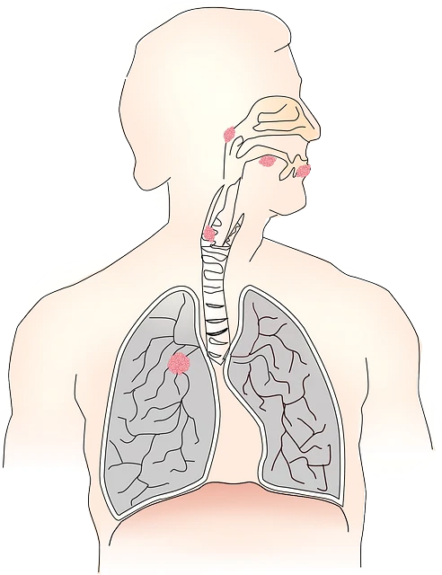 急性咽炎：诊断与治疗的全面解析