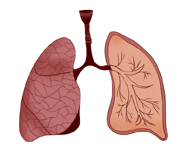 老年人的肺健康警钟——慢性阻塞性肺疾病你了解多少？