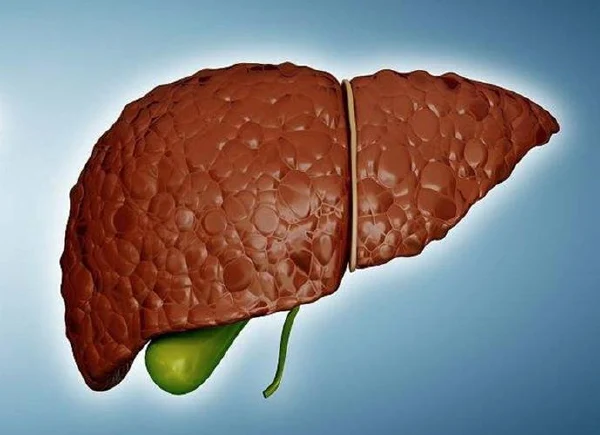 肝硬化及其并发症的全面探讨