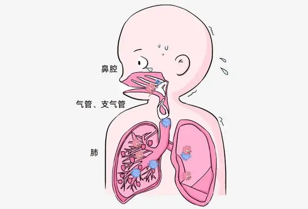 儿童急性上呼吸道感染：你需要知道的一切！封面图