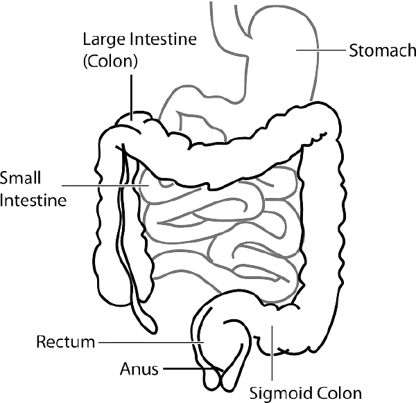 小肠梗阻的全面解析：从分类到诊疗