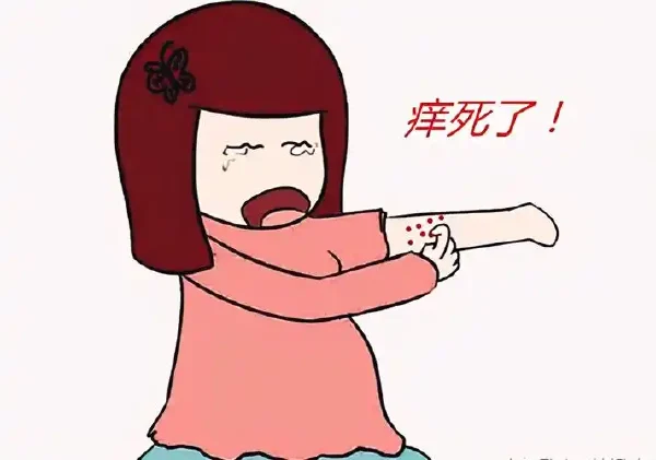 解密慢性荨麻疹：从症状到预防，你需要知道的一切