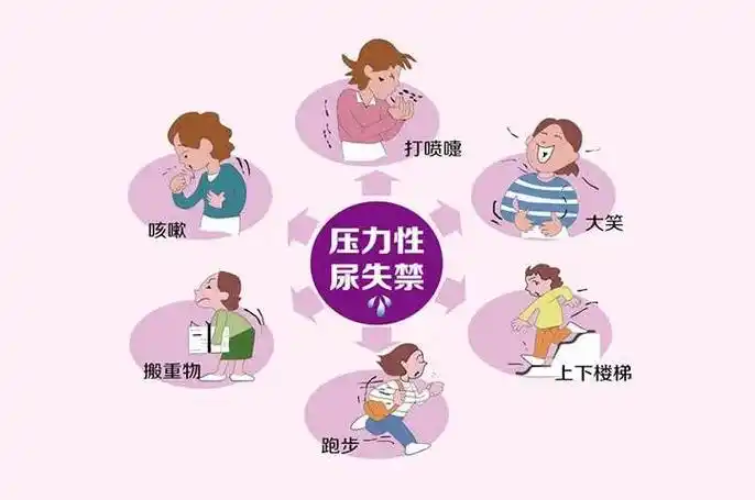 压力性尿失禁：何为根源，如何应对？