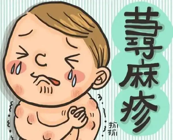 慢性荨麻疹：你需要了解的健康守护指南