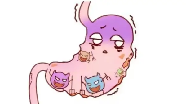 了解急性胃肠炎:症状、诊断和治疗