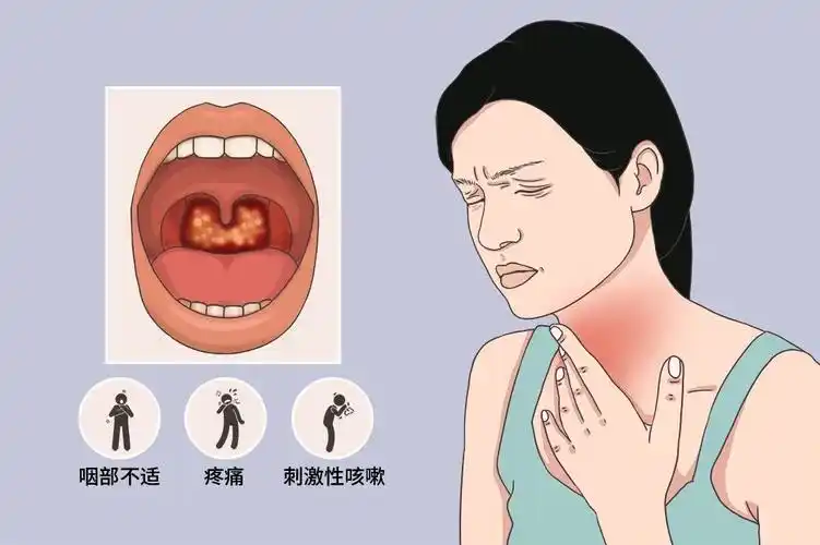 全面解析过敏性咽喉炎：病因、诊断与治疗