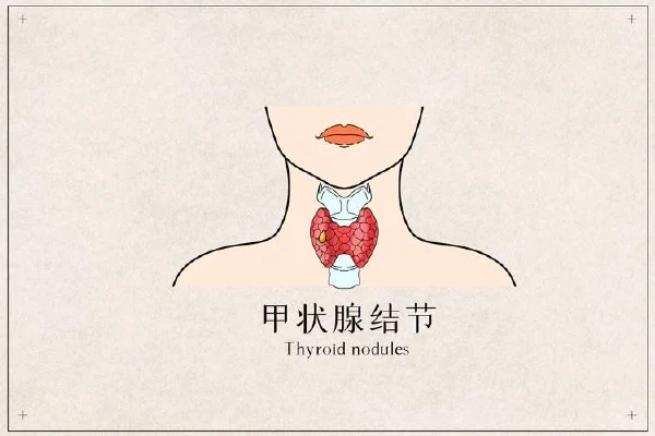 甲状腺和临近器官:从检查报告到健康管理