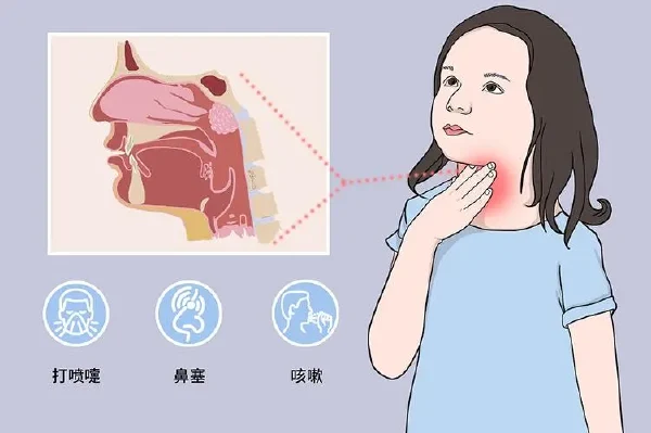 小儿急性上呼吸道感染:你需要了解的关键事实!
