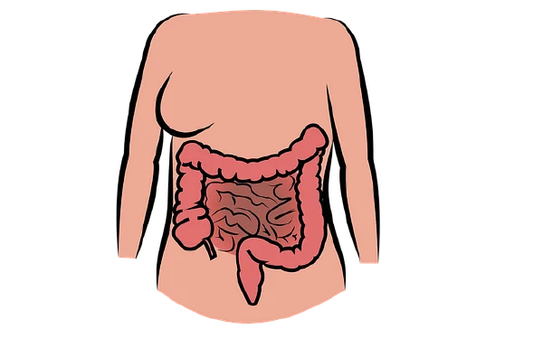 认识肠梗阻：从病因到治疗