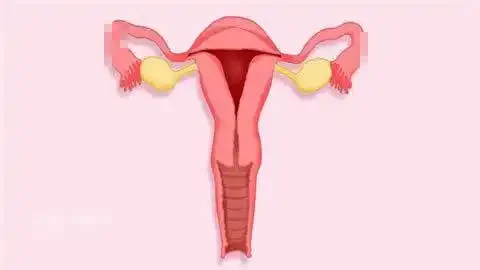 关爱女性健康:子宫肌瘤的防治指南