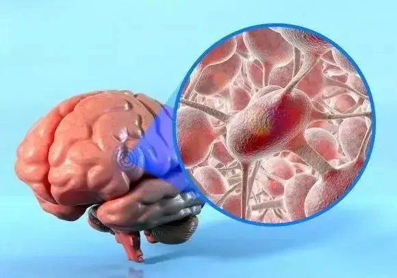 脑恶性肿瘤的综合管理与患者生活指导