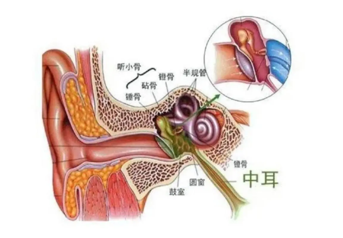 化脓性中耳炎的综合管理与治疗