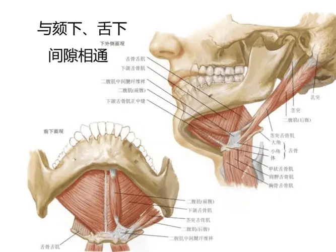 揭秘颌面间隙感染——须重视的潜在威胁！