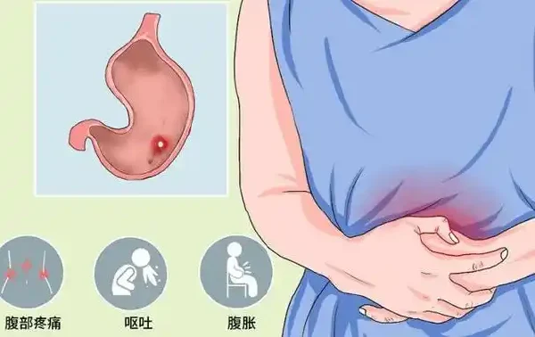 胃病与脾虚失运症：诊断、分类与综合治疗指南