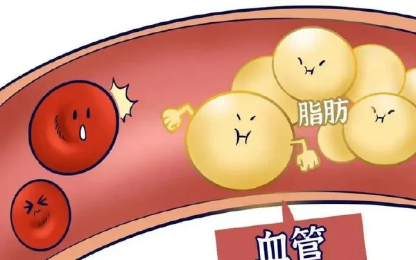 依洛尤单抗：高脂血症患者的新选择！——揭开背后的药理秘密