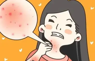 丘疹性荨麻疹：让你了解它的前因后果、治疗办法以及预防措施