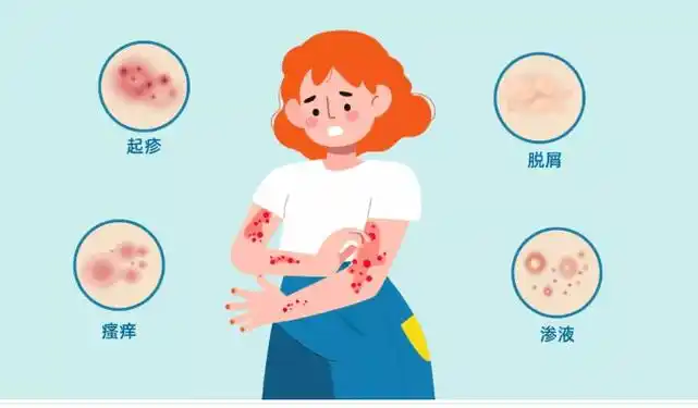 过敏性皮炎:全面解析与防治策略