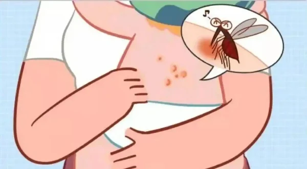 荨麻疹：了解原因及如何有效预防