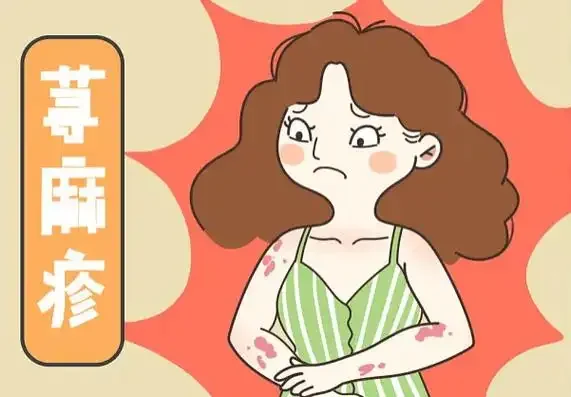 荨麻疹不可轻视，一次发作可能意味着什么！