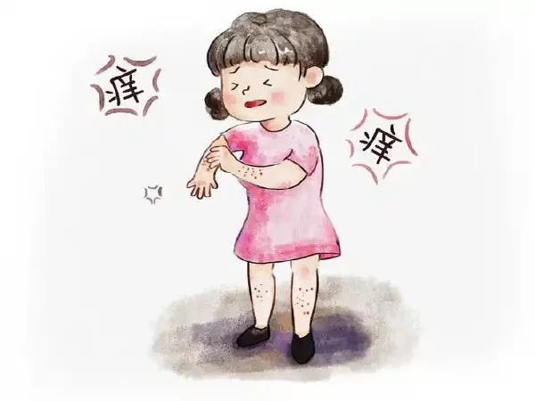 皮炎：识别、治疗与预防全指南