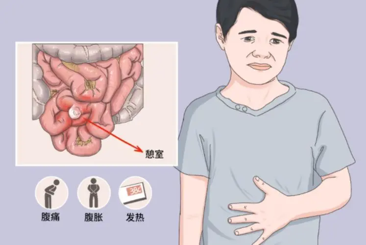 探索空腔脏器穿孔与小肠穿孔的诊断与治疗封面图