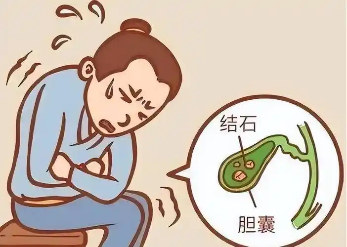 胆石症：<span style="color: #da4707">病因</span>、诊断与管理