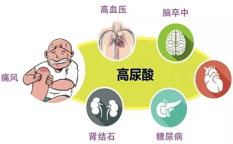 高尿酸血症：全面解读及科学管理