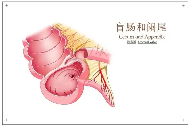 急性阑尾炎：潜伏在身边的危机封面图