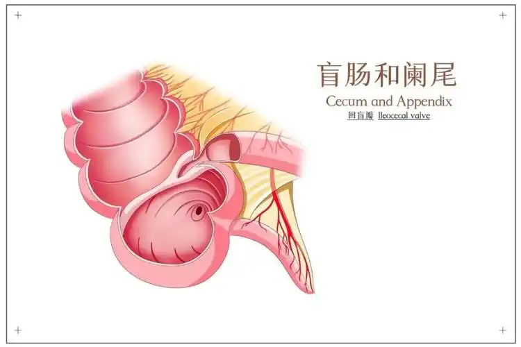 急性阑尾炎：潜伏在身边的危机