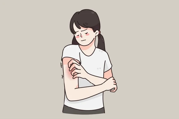 解密荨麻疹：了解、预防与解决方案
