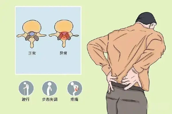颈椎前路手术麻醉:如何实现精准化与安全性平衡?