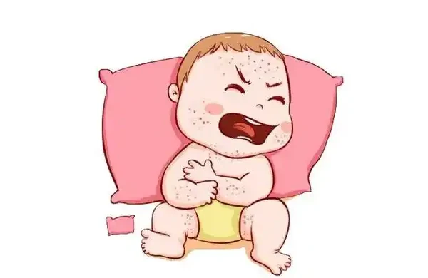 远离慢性荨麻疹：掌握预防与治疗方法，轻松生活