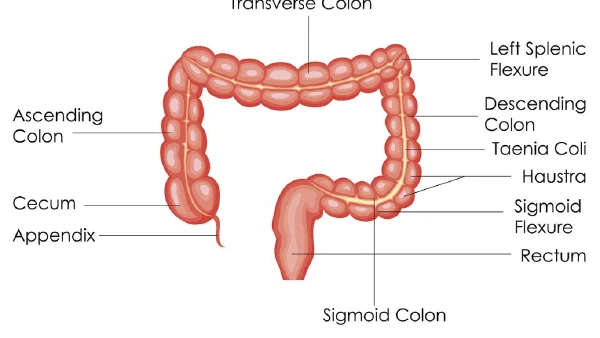 缺血性肠病:诊断与治疗的全面指南