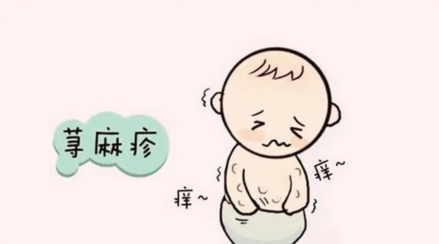 揭开慢性荨麻疹与<span style="color: #da4707">疣</span>的“神秘面纱”