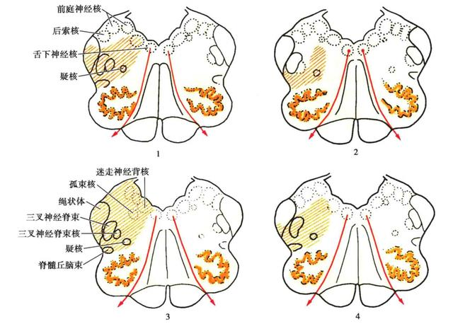 延髓背侧肿瘤性病变及其综合管理封面图