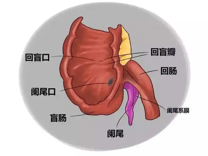 右<span style="color: #da4707">下腹</span>痛：急性阑尾炎的全面解析